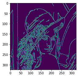 ../../_images/ch13_gradient_and_edge_detection_41_0.png